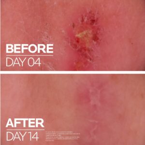 La Roche-Posay CICAPLAST BAUME B5 SPF50 Balzam za bebe, decu i odrasle koji obnavlja i umiruje nadraženu kožu i trenutno umiruje osećaj peckanja, 40 ml