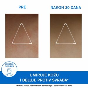 Uriage Xemose cerat 200ml
