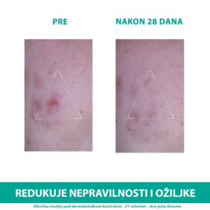Uriage Hyseac 3-regul krema 40ml