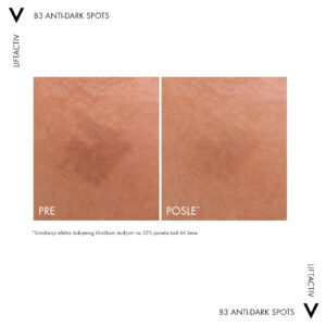 VICHY LIFTACTIV SPECIALIST B3 DARK SPOTS SERUM, serum protiv tamnih hiperpignemntacijskih fleka i bora, 30 ml