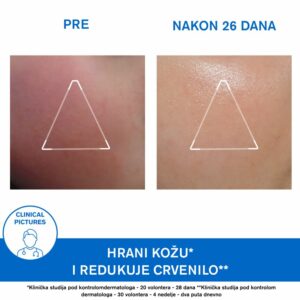 Uriage Xemose krema za lice 40ml