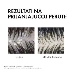 VICHY DERCOS AD Šampon protiv peruti za suvu kosu 200ml